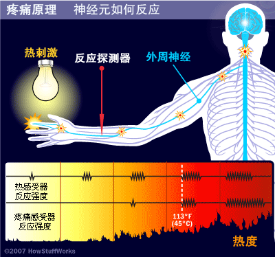 疼痛感