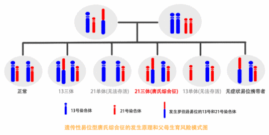 罗伯逊易位