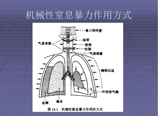 机械性窒息