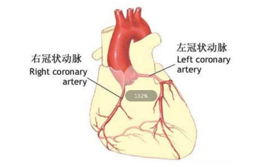 冠状动脉心腔瘘