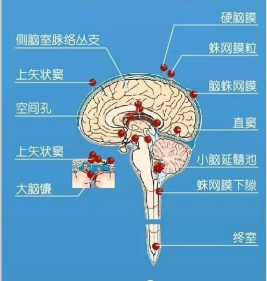 病理反射