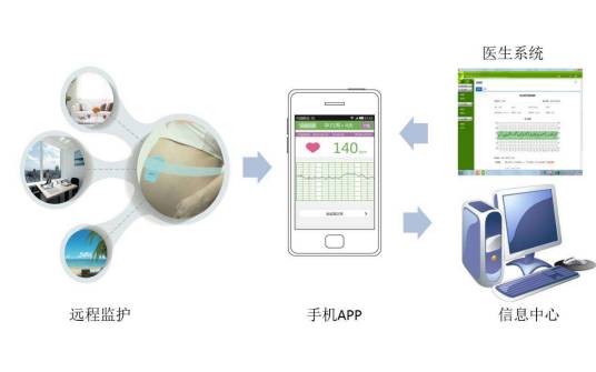 远程胎心监护系统
